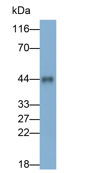 Monoclonal Antibody to Tissue Factor (TF)