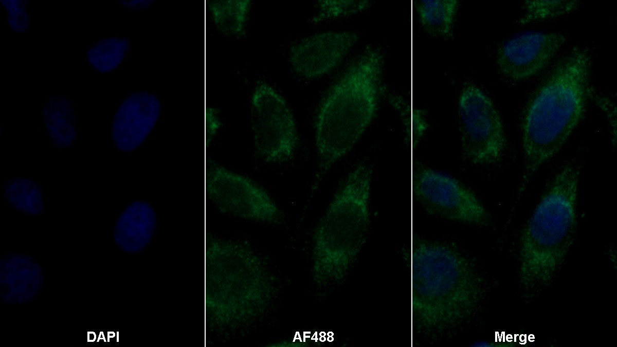 Monoclonal Antibody to Tissue Plasminogen Activator (tPA)