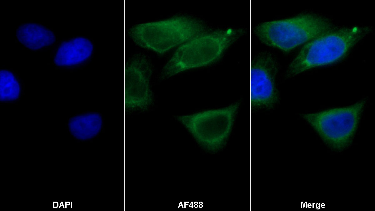 Monoclonal Antibody to Tissue Plasminogen Activator (tPA)