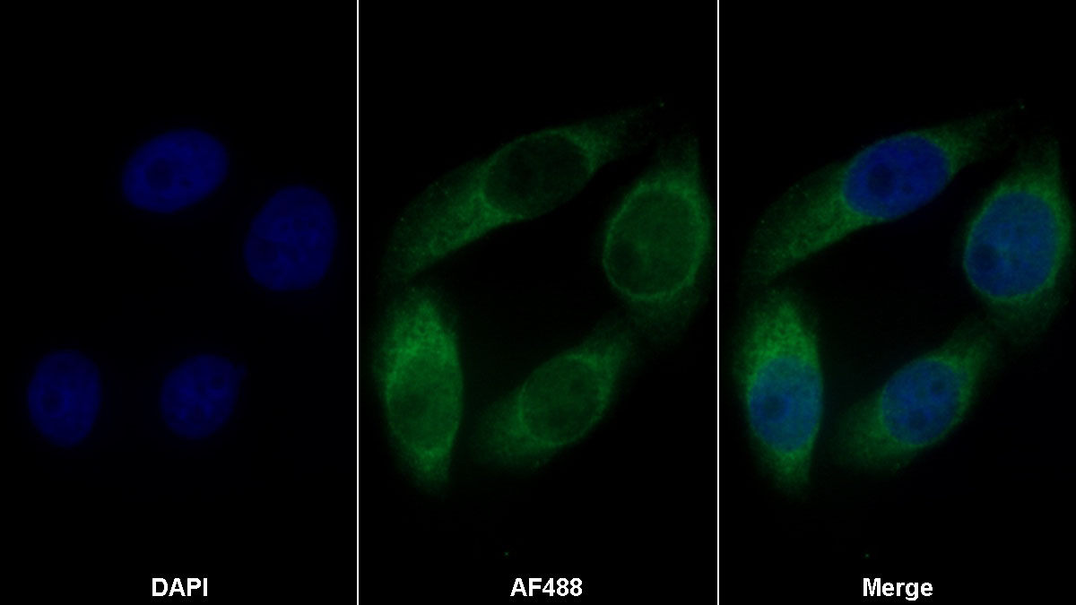 Monoclonal Antibody to Tissue Plasminogen Activator (tPA)