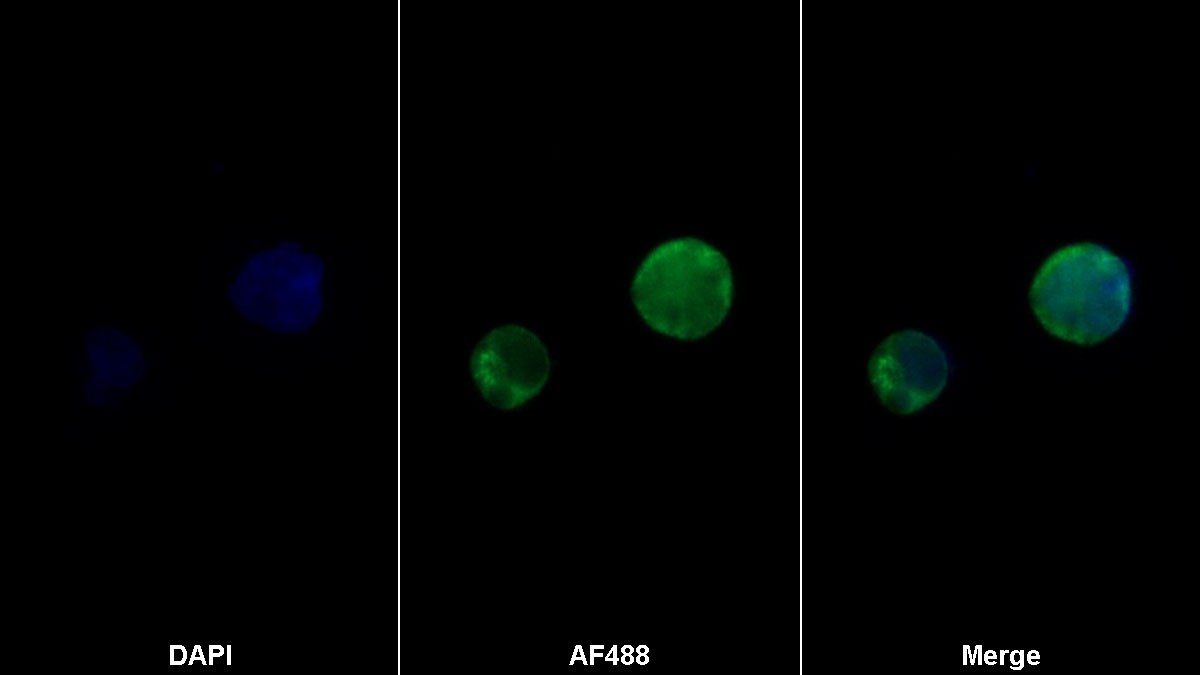 Monoclonal Antibody to Tissue Plasminogen Activator (tPA)