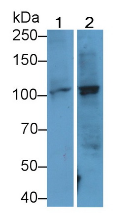 Monoclonal Antibody to Thrombomodulin (TM)