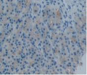 Monoclonal Antibody to Plasminogen Activator Inhibitor 2 (PAI2)