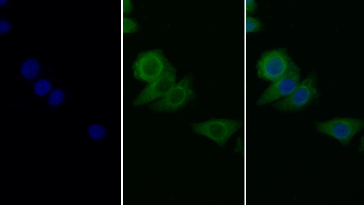 Monoclonal Antibody to Plasminogen Activator Inhibitor 1 (PAI1)