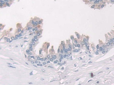 Monoclonal Antibody to Plasminogen Activator Inhibitor 1 (PAI1)