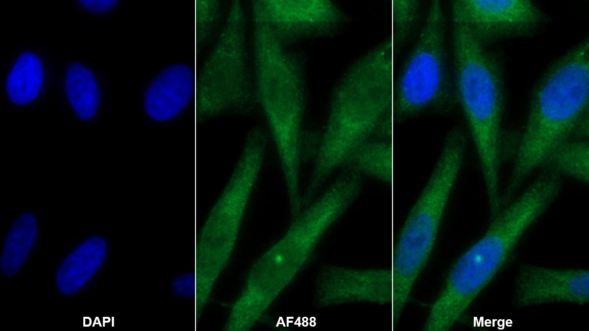 Monoclonal Antibody to Plasminogen Activator Inhibitor 1 (PAI1)