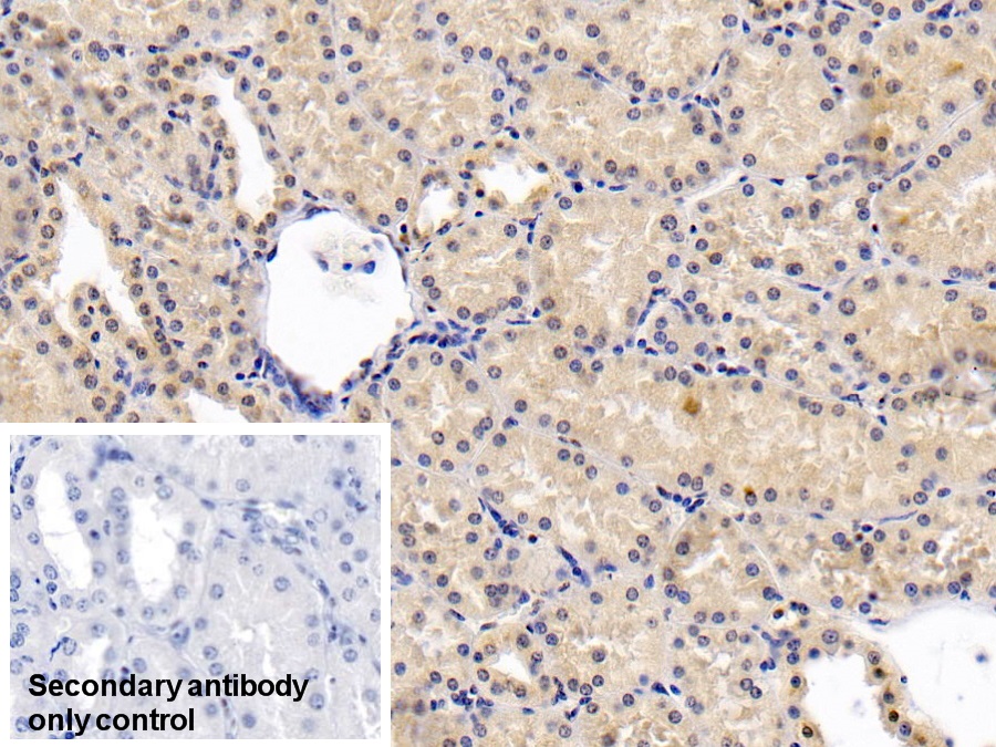 Monoclonal Antibody to Plasminogen Activator Inhibitor 1 (PAI1)