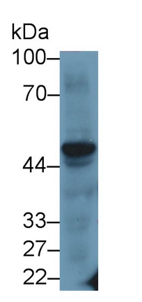 Monoclonal Antibody to Plasminogen Activator Inhibitor 1 (PAI1)