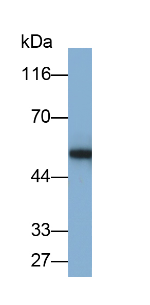 Monoclonal Antibody to Plasminogen Activator Inhibitor 1 (PAI1)