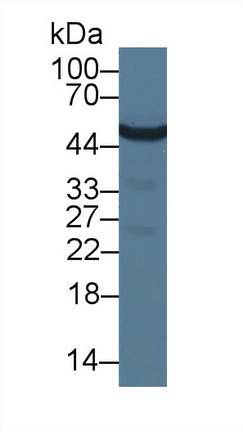 Monoclonal Antibody to Enolase, Neuron Specific (NSE)