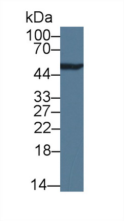 Monoclonal Antibody to Enolase, Neuron Specific (NSE)