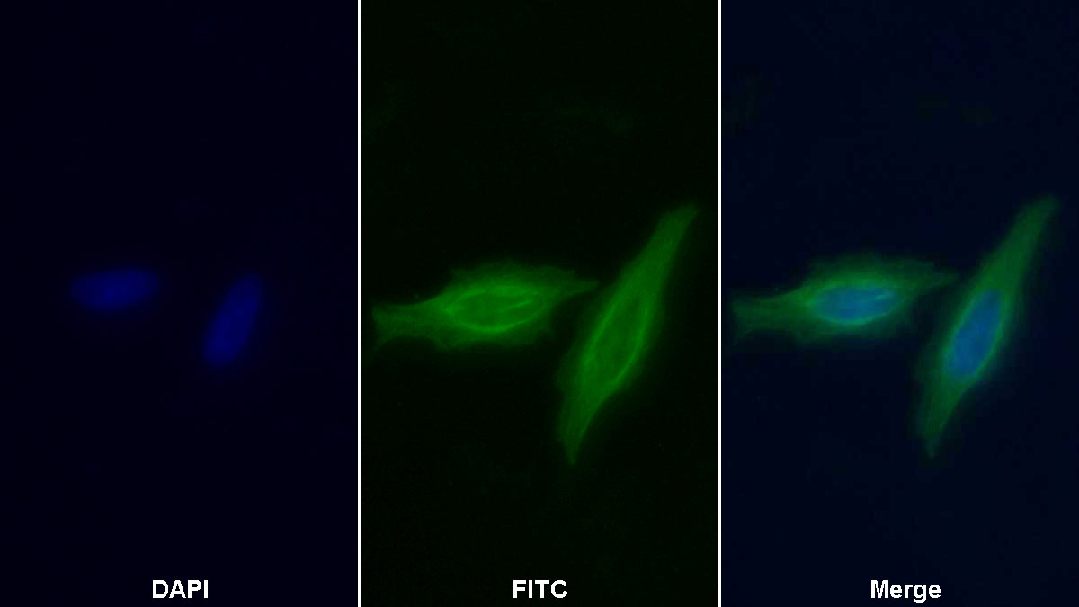 Monoclonal Antibody to Enolase, Neuron Specific (NSE)