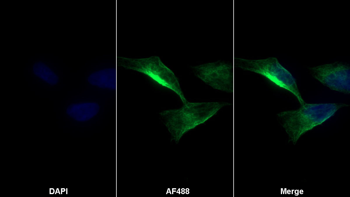 Monoclonal Antibody to Enolase, Neuron Specific (NSE)