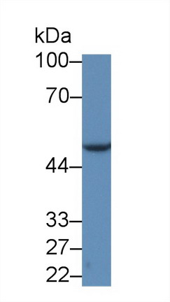 Monoclonal Antibody to Enolase, Neuron Specific (NSE)