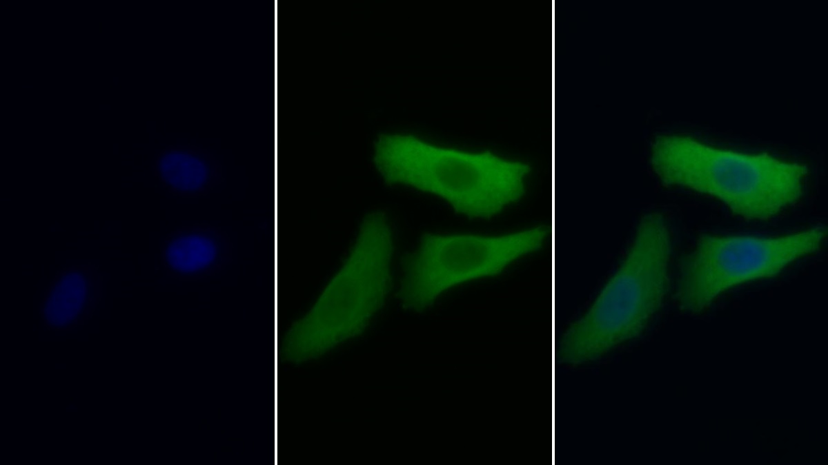 Monoclonal Antibody to Enolase, Neuron Specific (NSE)