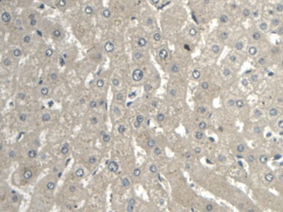 Monoclonal Antibody to Enolase, Neuron Specific (NSE)