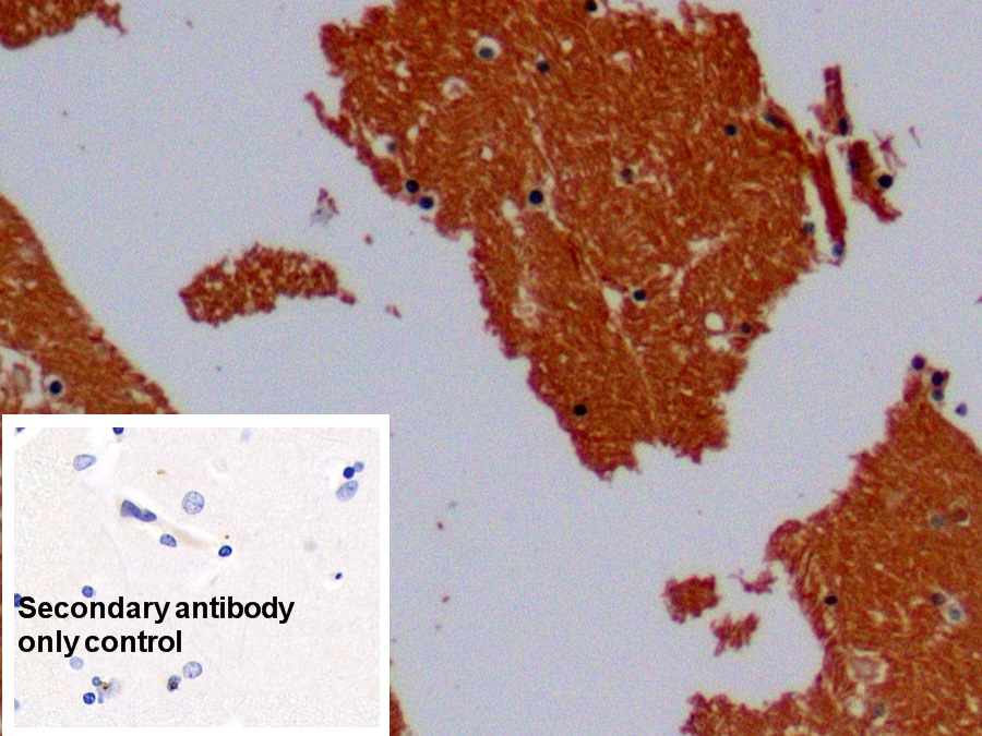 Monoclonal Antibody to Enolase, Neuron Specific (NSE)