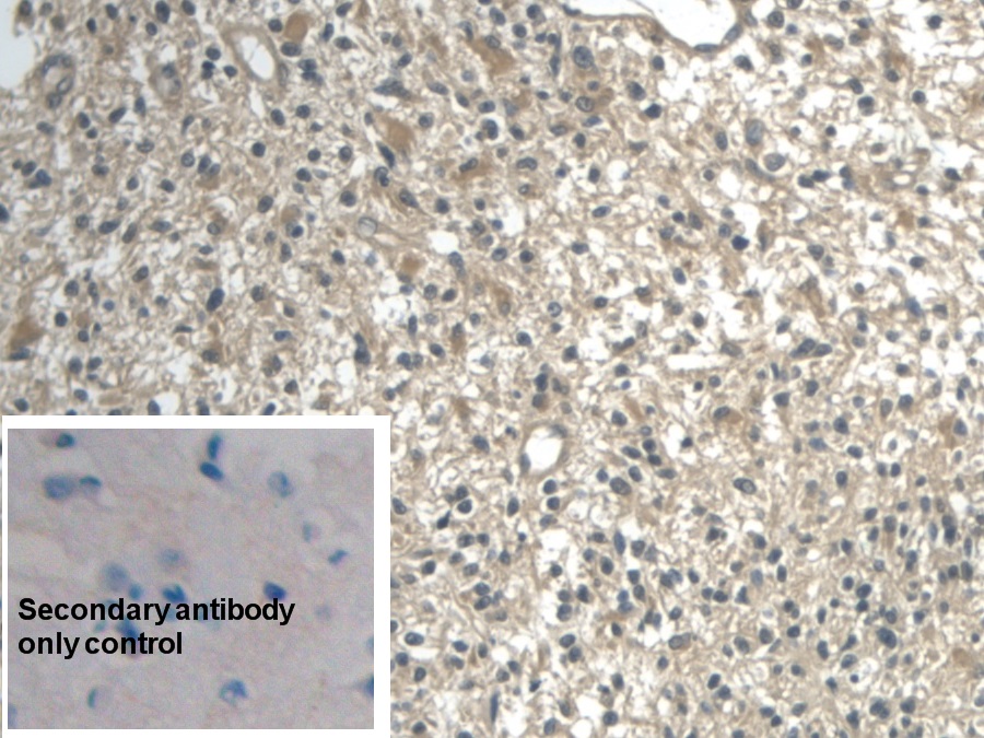 Monoclonal Antibody to Enolase, Neuron Specific (NSE)