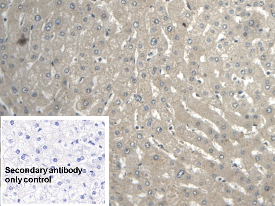 Monoclonal Antibody to Enolase, Neuron Specific (NSE)