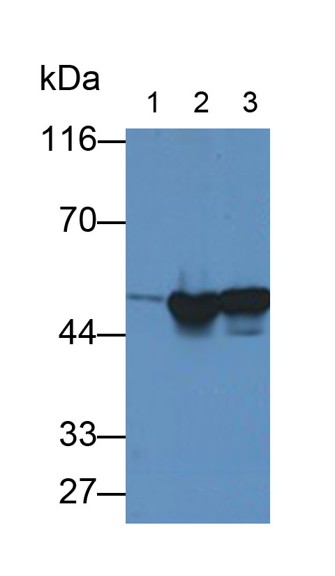 Monoclonal Antibody to Enolase, Neuron Specific (NSE)