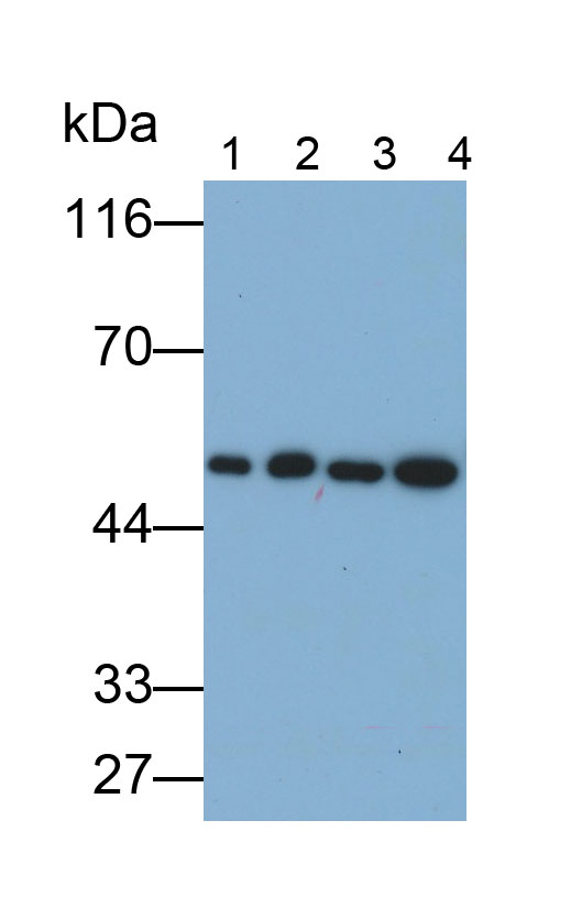 Monoclonal Antibody to Enolase, Neuron Specific (NSE)