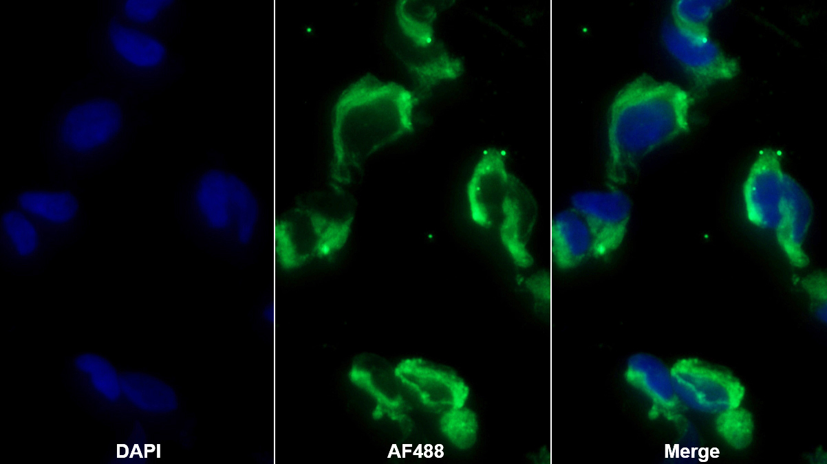 Monoclonal Antibody to Enolase, Neuron Specific (NSE)