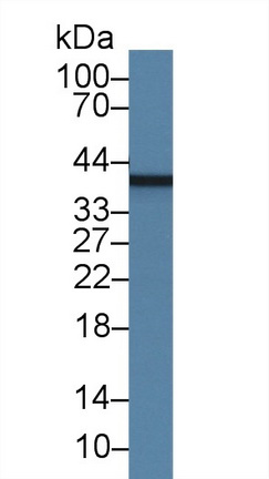 Monoclonal Antibody to Myelin Basic Protein (MBP)