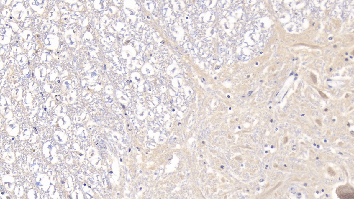 Monoclonal Antibody to Myelin Basic Protein (MBP)