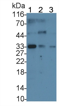 Monoclonal Antibody to Myelin Basic Protein (MBP)