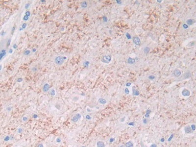 Monoclonal Antibody to Brain Natriuretic Peptide (BNP)