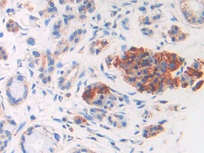 Monoclonal Antibody to Brain Natriuretic Peptide (BNP)