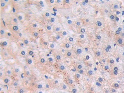 Monoclonal Antibody to Brain Natriuretic Peptide (BNP)