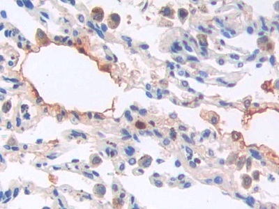 Monoclonal Antibody to Brain Natriuretic Peptide (BNP)