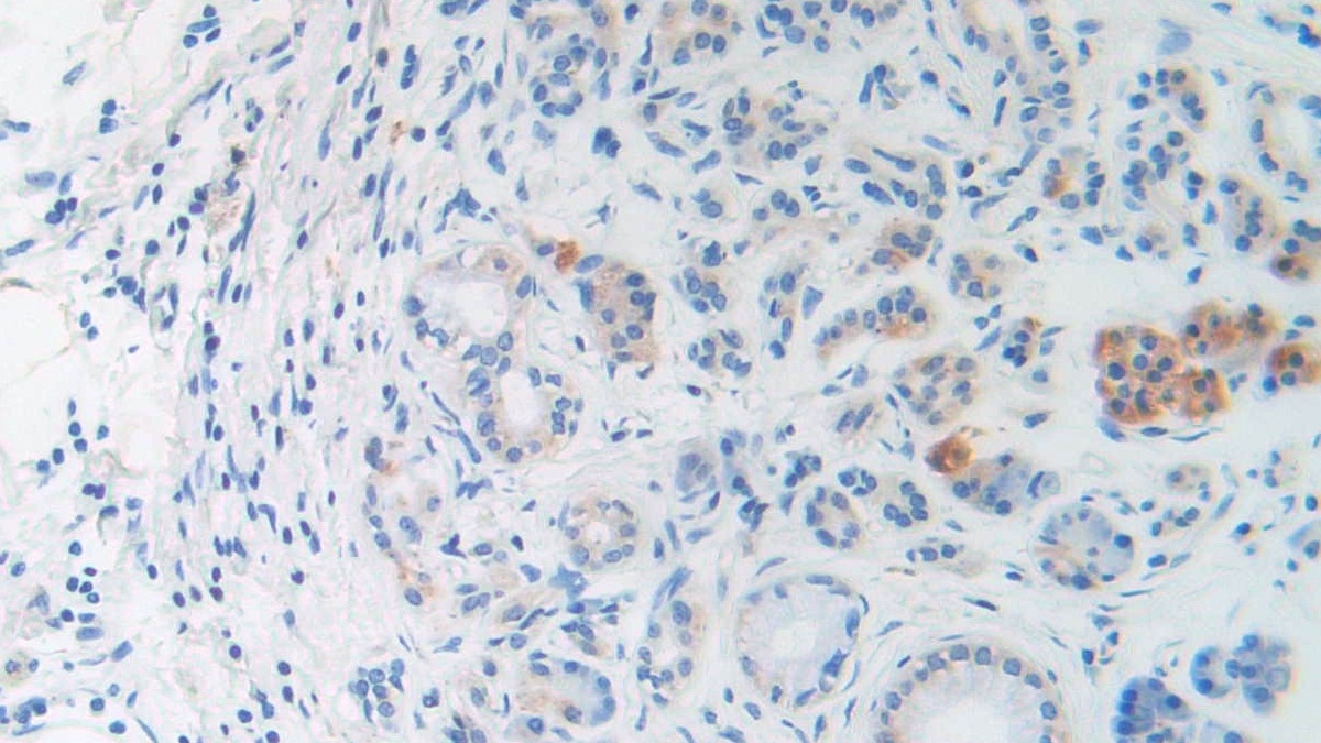 Monoclonal Antibody to Brain Natriuretic Peptide (BNP)