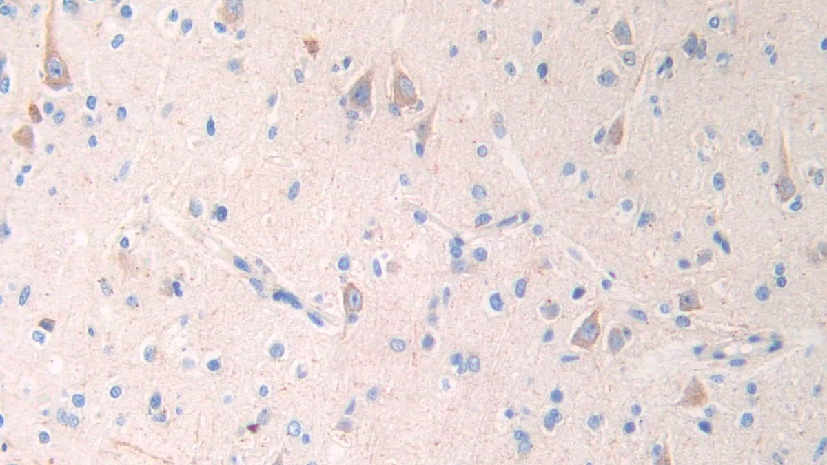 Monoclonal Antibody to Brain Natriuretic Peptide (BNP)