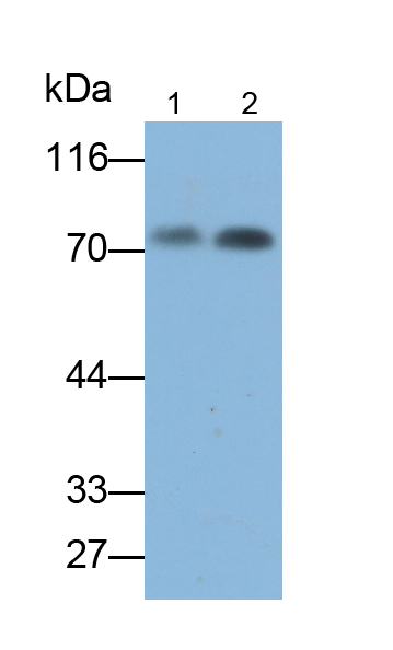 Monoclonal Antibody to Immunoglobulin M (IgM)