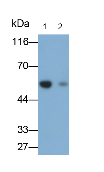 Monoclonal Antibody to Immunoglobulin G (IgG)