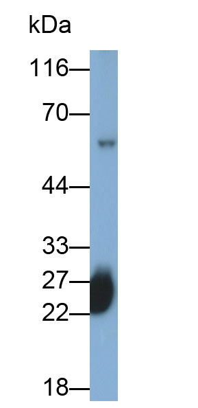 Monoclonal Antibody to Immunoglobulin G (IgG)