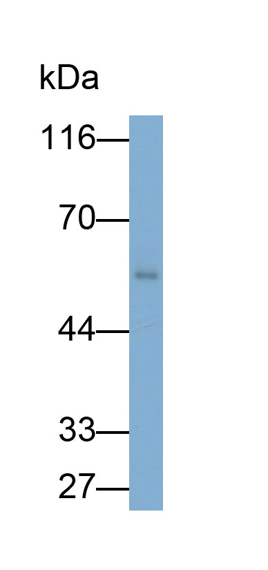 Monoclonal Antibody to Immunoglobulin G (IgG)