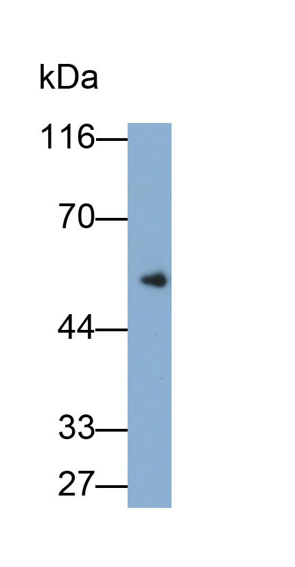 Monoclonal Antibody to Immunoglobulin G (IgG)