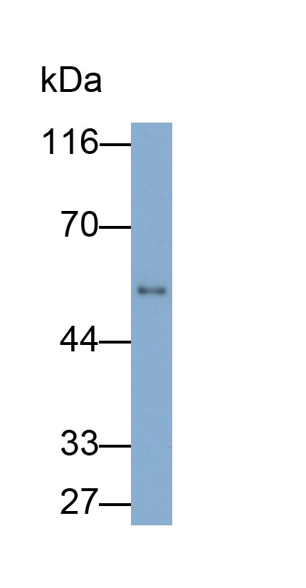 Monoclonal Antibody to Immunoglobulin G (IgG)