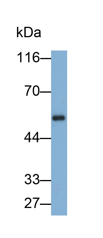 Monoclonal Antibody to Immunoglobulin G (IgG)