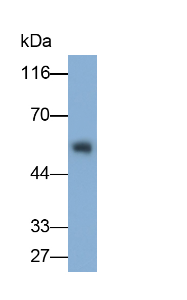 Monoclonal Antibody to Immunoglobulin G (IgG)