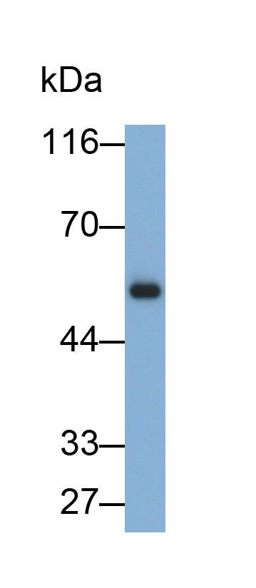 Monoclonal Antibody to Immunoglobulin G (IgG)