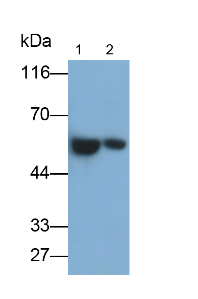 Monoclonal Antibody to Immunoglobulin G (IgG)