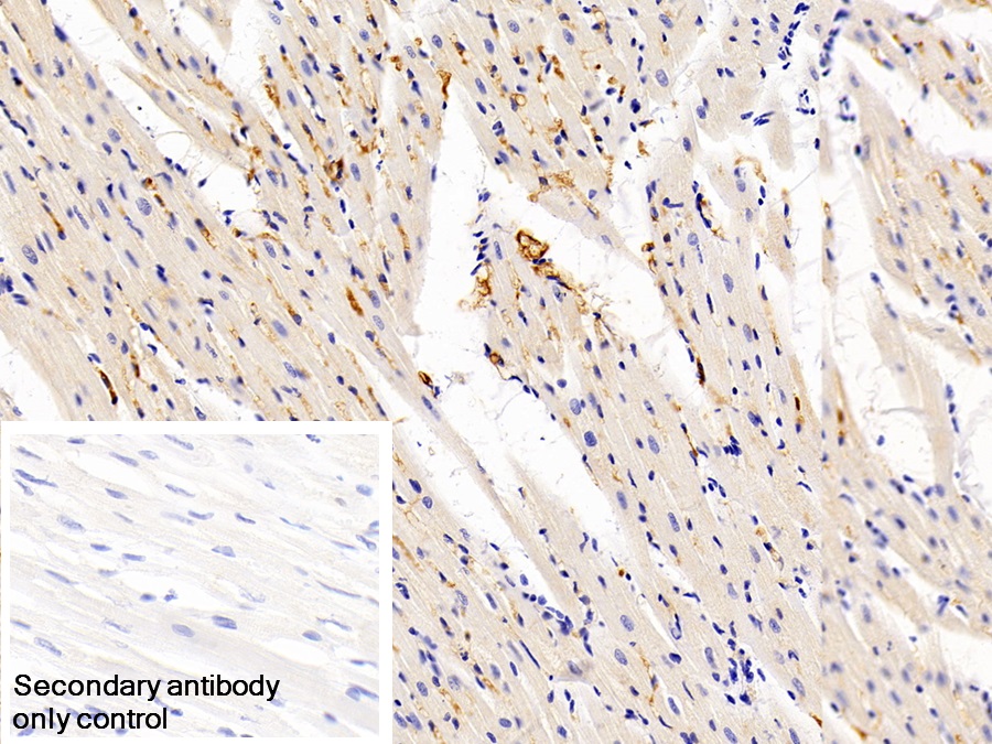 Monoclonal Antibody to Immunoglobulin G (IgG)