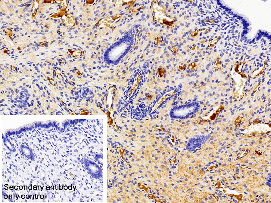 Monoclonal Antibody to Immunoglobulin G (IgG)