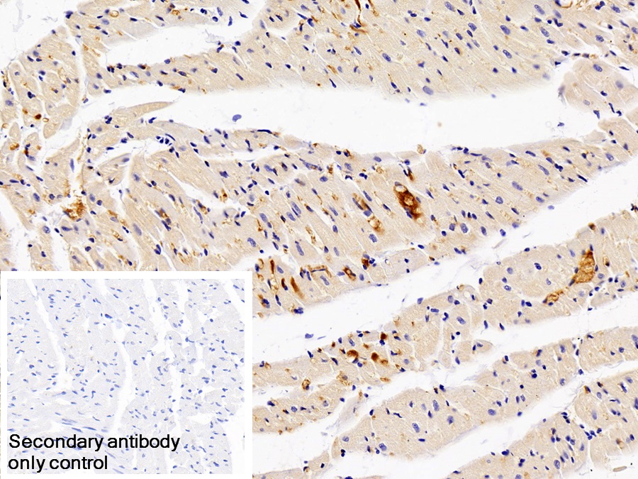 Monoclonal Antibody to Immunoglobulin G (IgG)