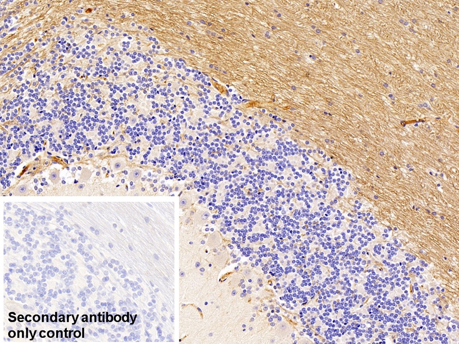 Monoclonal Antibody to Immunoglobulin G (IgG)