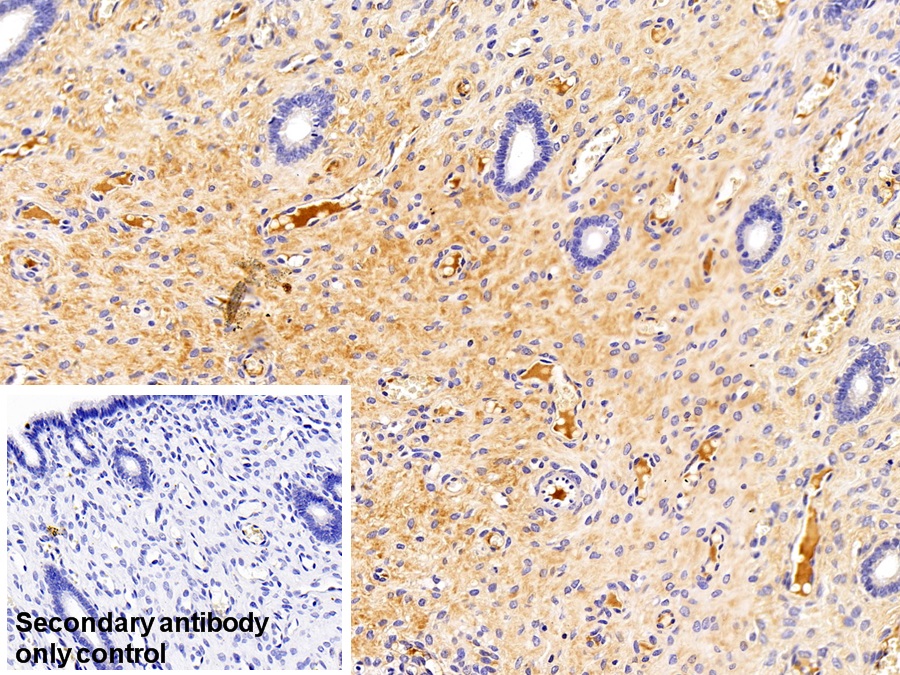 Monoclonal Antibody to Immunoglobulin G (IgG)